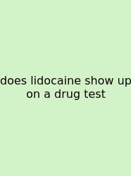 Does Lidocaine Show Up On A Drug Test